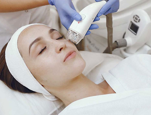 ziba spa Uxbridge Fractional RF Microneedling Image
