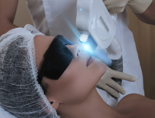 ziba spa Uxbridge IPL Acne Treatment Image